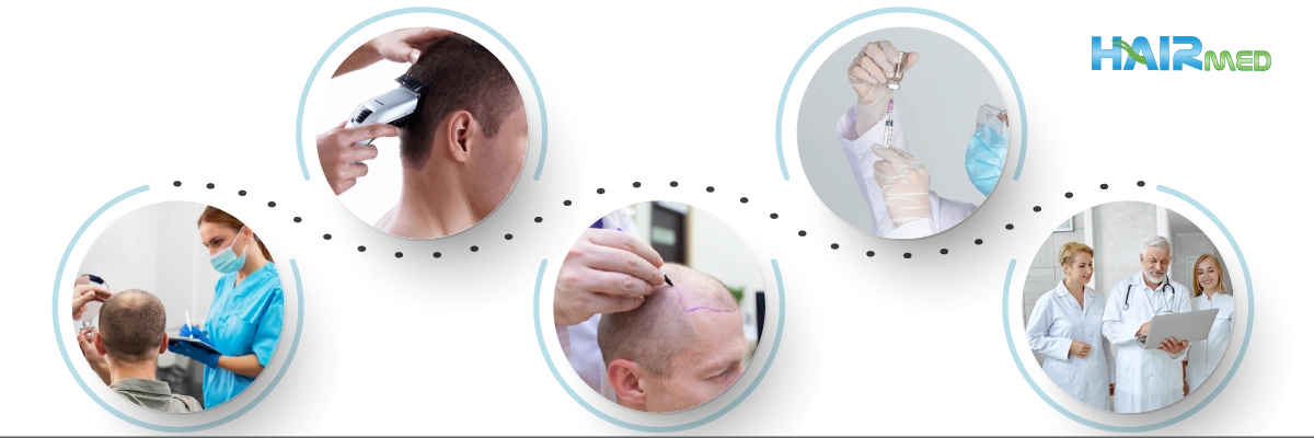 What is Fue Hair Transplant Technique and How is it Applied