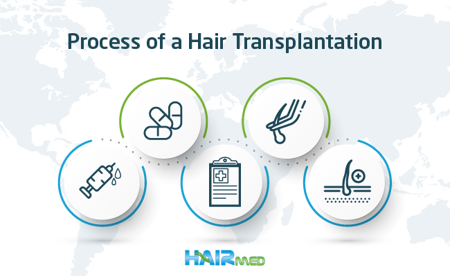 Process of a Hair Transplantation