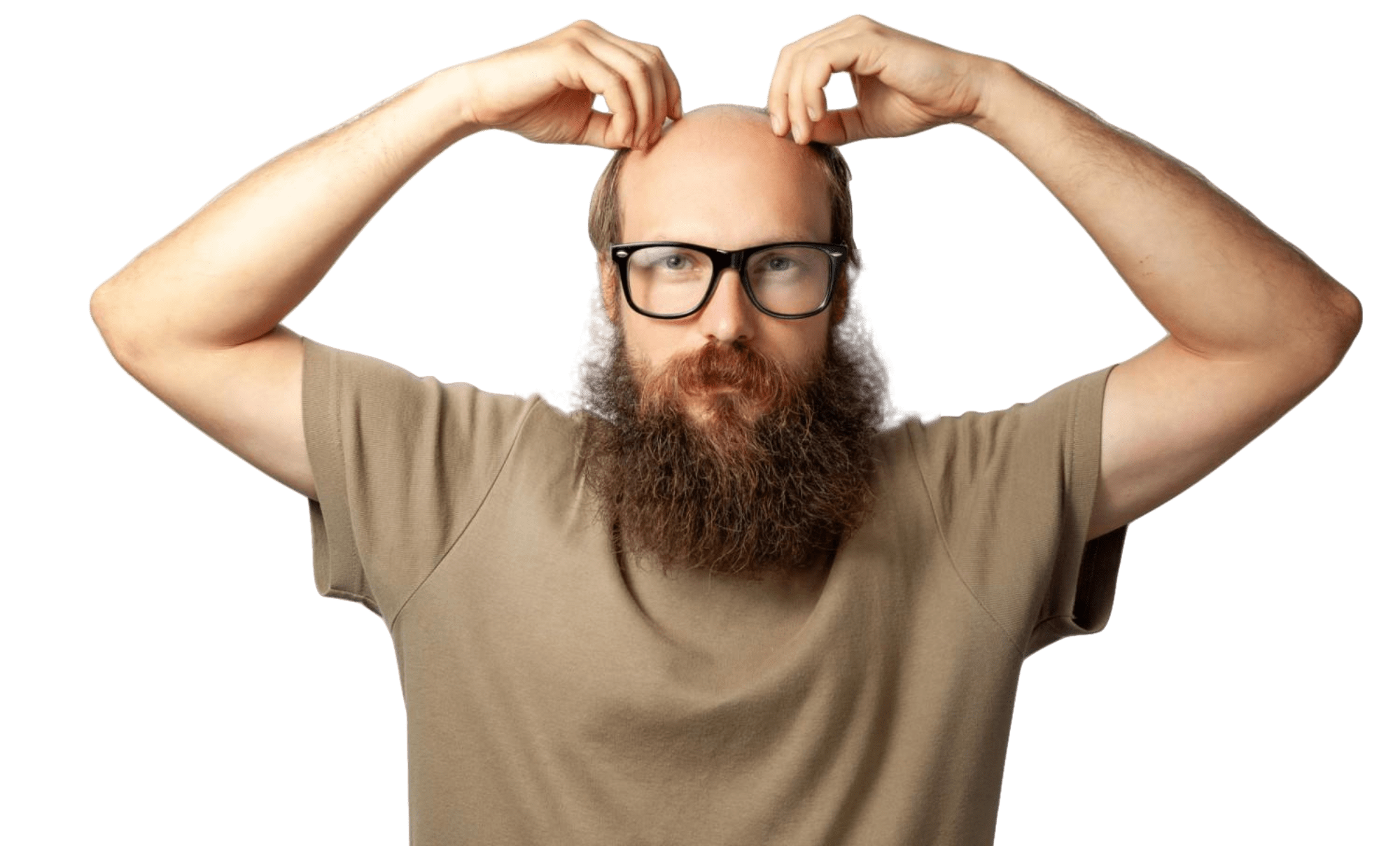 How is beard transplant done?